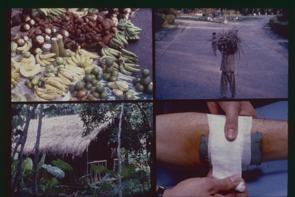 Fruit, boy, hut, bandage - Growing Concerns